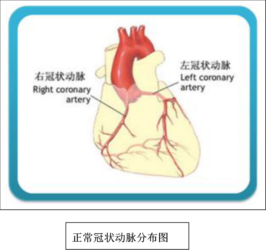 心脏二三尖瓣供血图图片